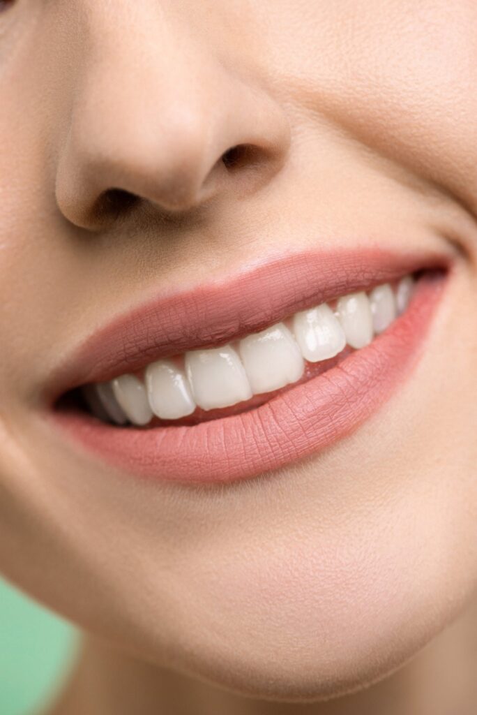 Close up Stock photo from pexels by Shiny Diamond of a woman smiling showing bright white teeth
